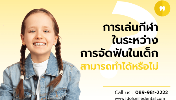 การเล่นกีฬา ในระหว่างการจัดฟันในเด็ก สามารถทำได้หรือไม่