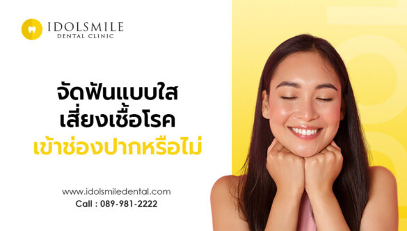 การจัดฟันแบบใส เสี่ยงทำให้เชื้อโรคเข้าช่องปากได้หรือไม่