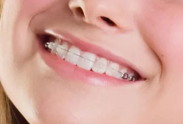 iTopPlus525860243654