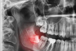 จัดฟันในเด็ก สามารถแก้ไขปัญหาฟันในเรื่องใดได้บ้าง
